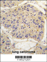IHC-P - FKBP12 Antibody (Center) AP7756c